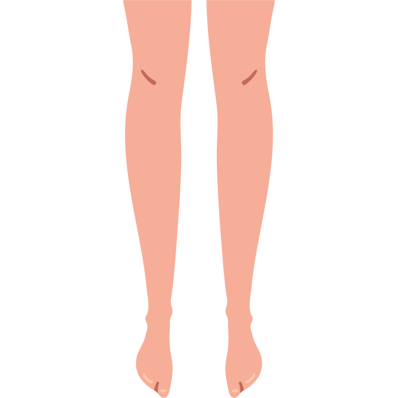 Legs with no visible swelling. Legs with no visible swelling.